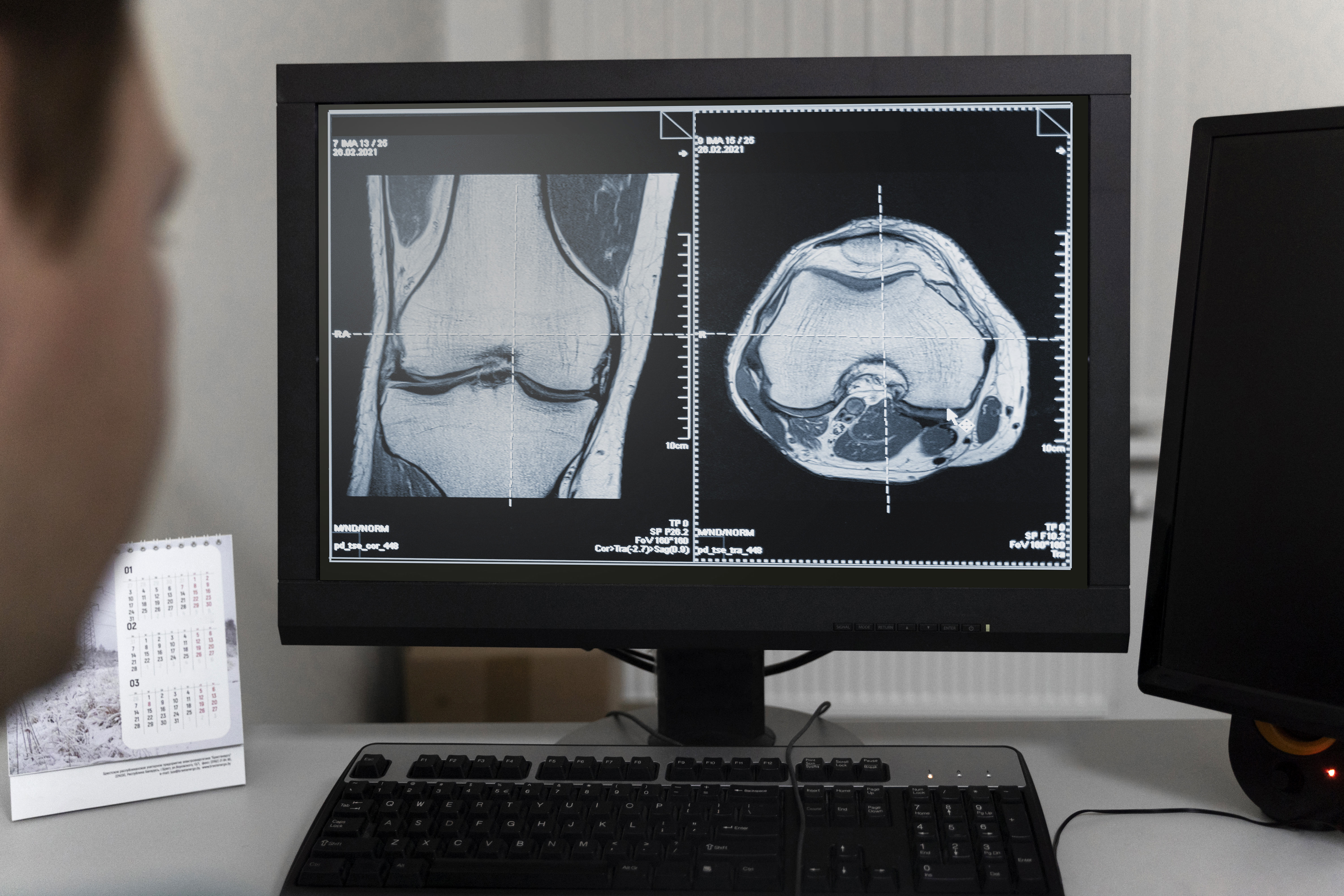 growth-of-teleradiology-market-in-india